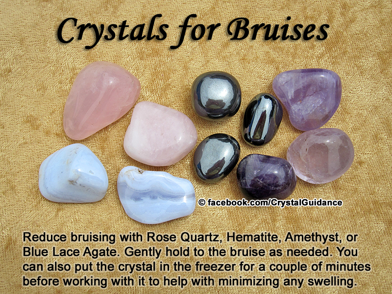 Crystals for Bruises